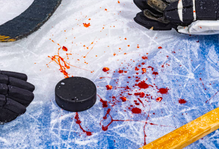 Palet et équipements de hockey sur une patinoire, illustrant la faute et l’engagement de la responsabilité en matière sportive.